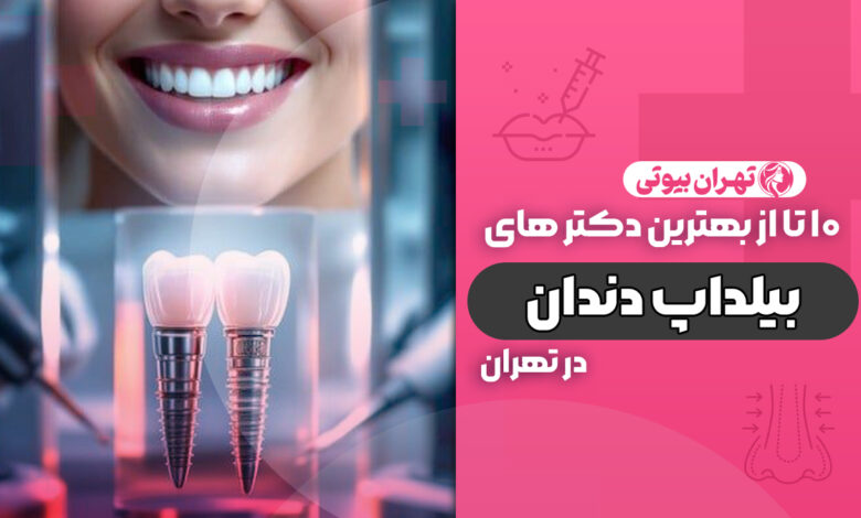 10 بهترین دکتر بیلداپ دندان در تهران