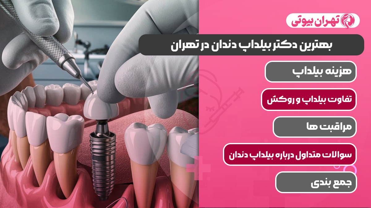 10 بهترین دکتر بیلداپ دندان در تهران