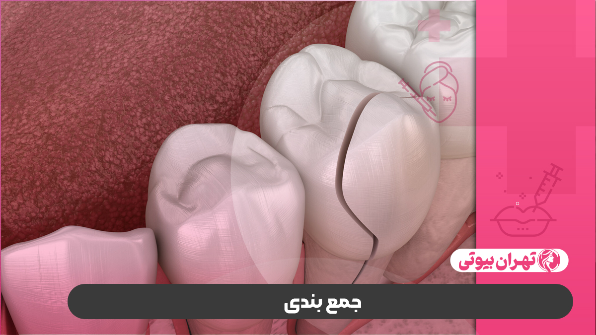 10 بهترین دکتر بیلداپ دندان در تهران