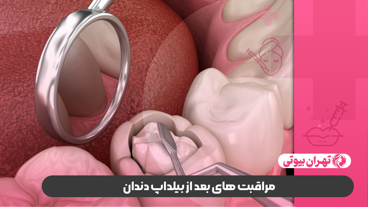 10 بهترین دکتر بیلداپ دندان در تهران