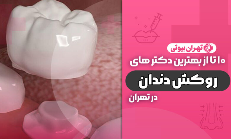 10 بهترین دکتر روکش دندان در تهران