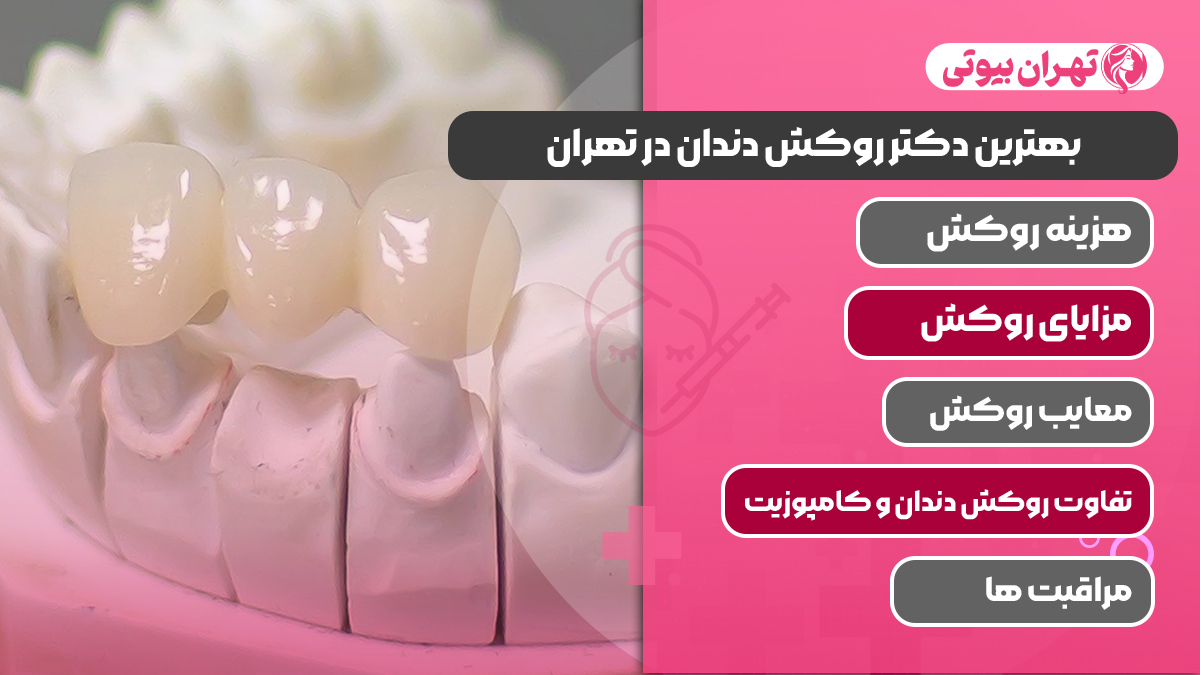 10 بهترین دکتر روکش دندان در تهران