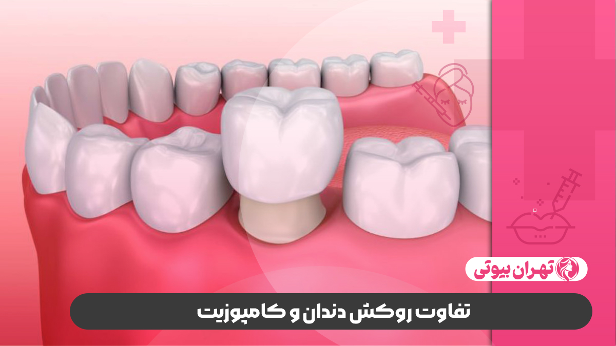 10 بهترین دکتر روکش دندان در تهران
