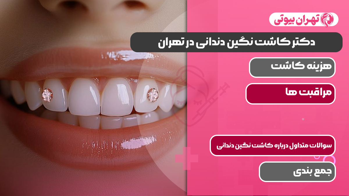 10 بهترین دکتر کاشت نگین دندانی در تهران