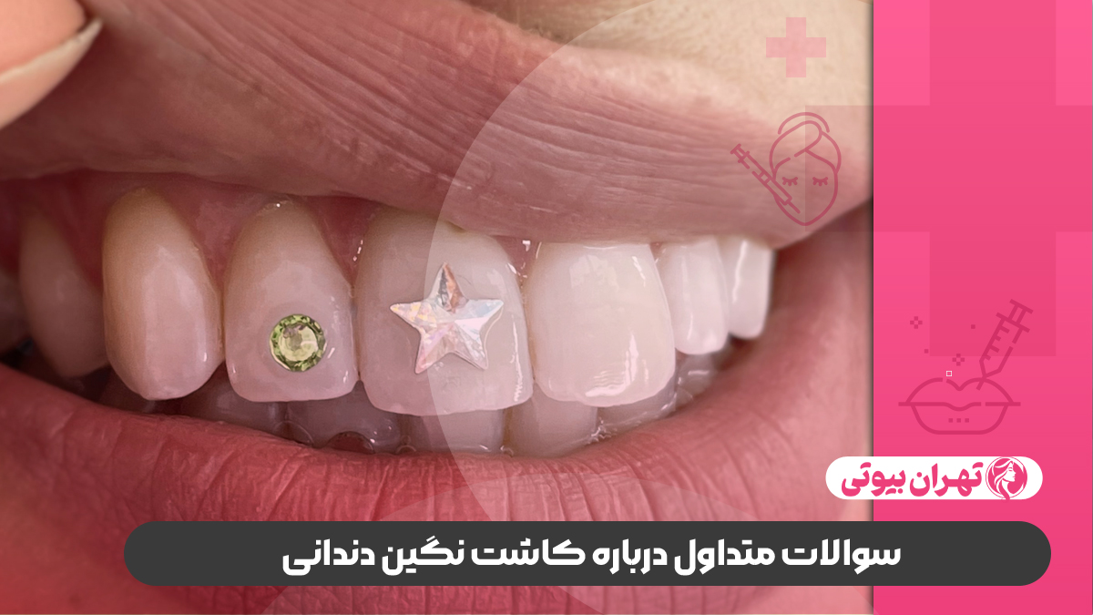 10 بهترین دکتر کاشت نگین دندانی در تهران