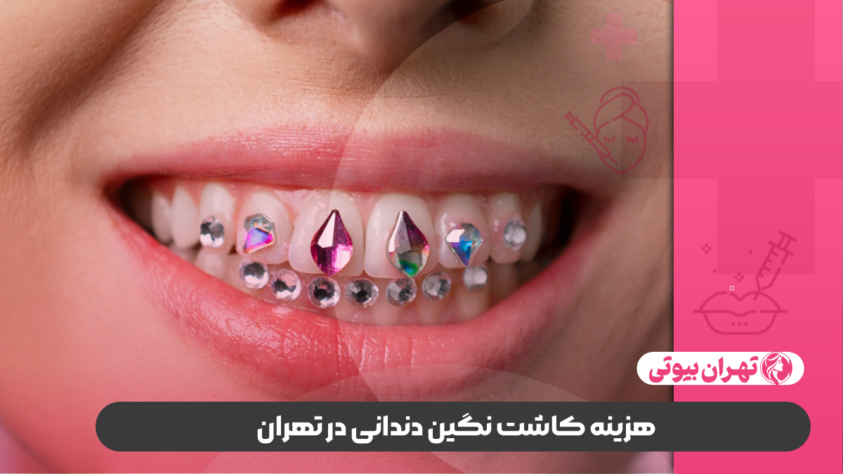 10 بهترین دکتر کاشت نگین دندانی در تهران