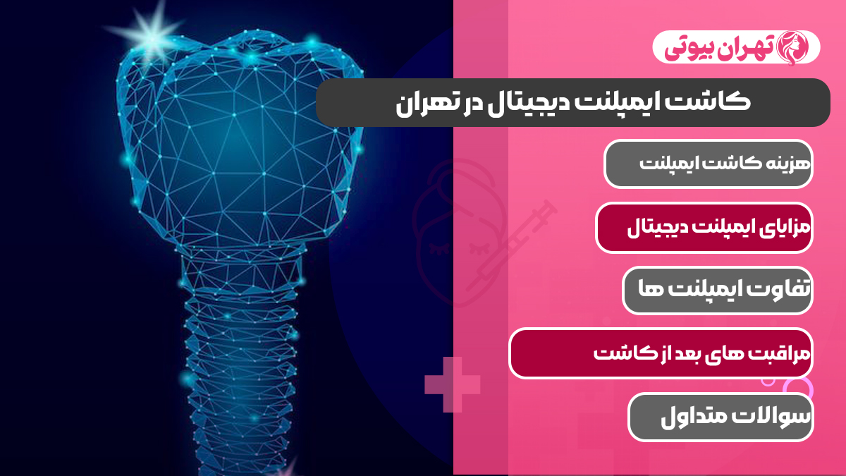 10 بهترین دکتر کاشت ایمپلنت دیجیتال در تهران
