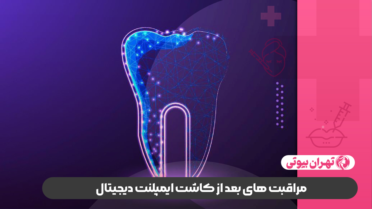 10 بهترین دکتر کاشت ایمپلنت دیجیتال در تهران