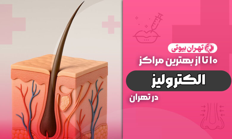 10 بهترین مرکز الکترولیز در تهران