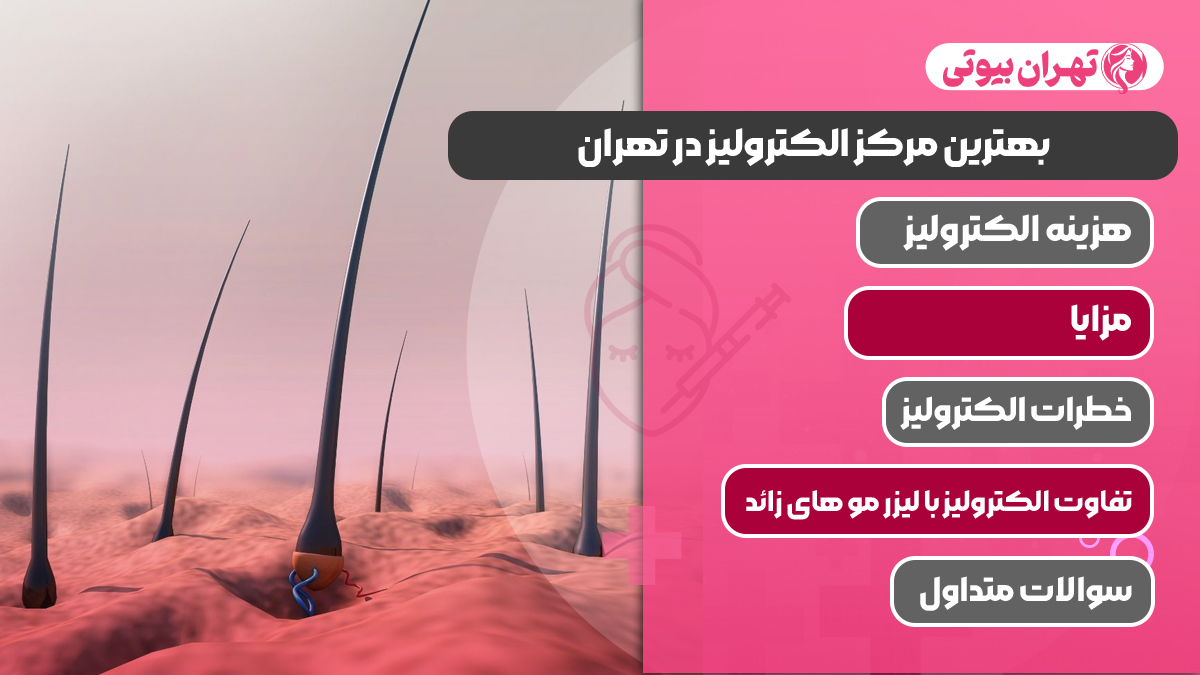 10 بهترین مرکز الکترولیز در تهران