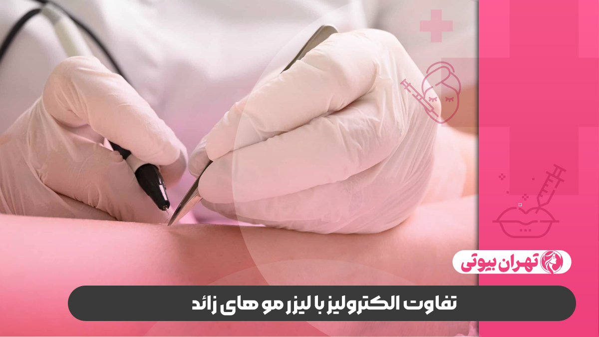 10 بهترین مرکز الکترولیز در تهران