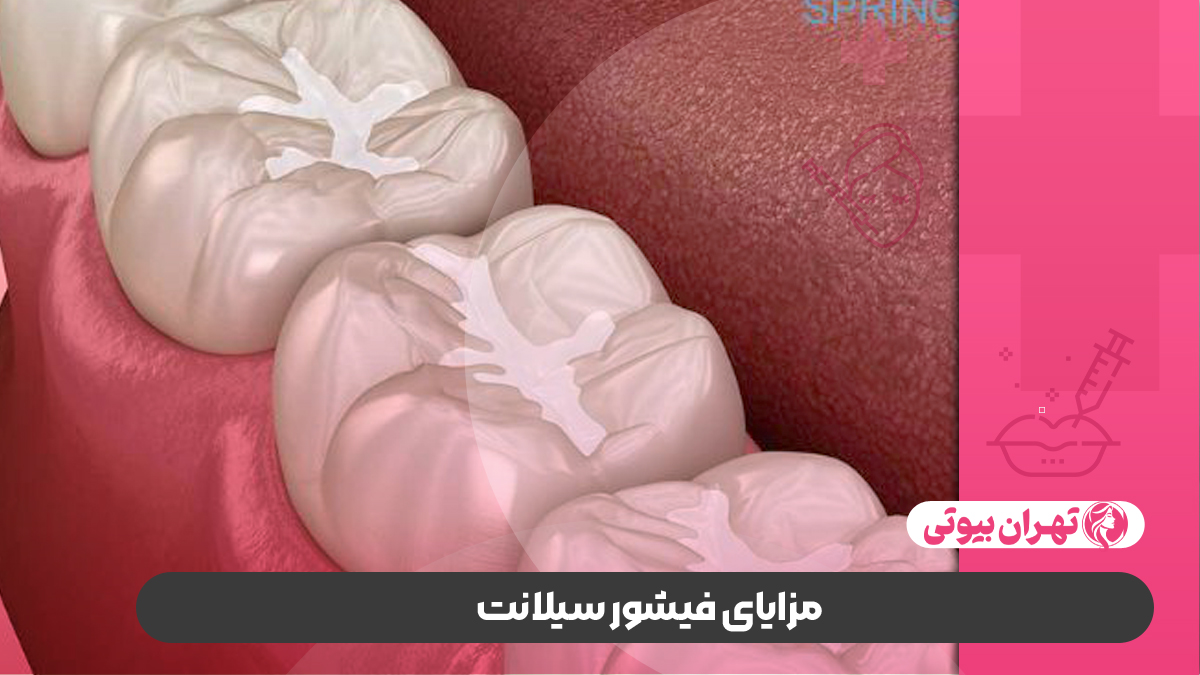 10 بهترین متخصص فیشور سیلانت در تهران