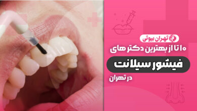 10 بهترین متخصص فیشور سیلانت در تهران
