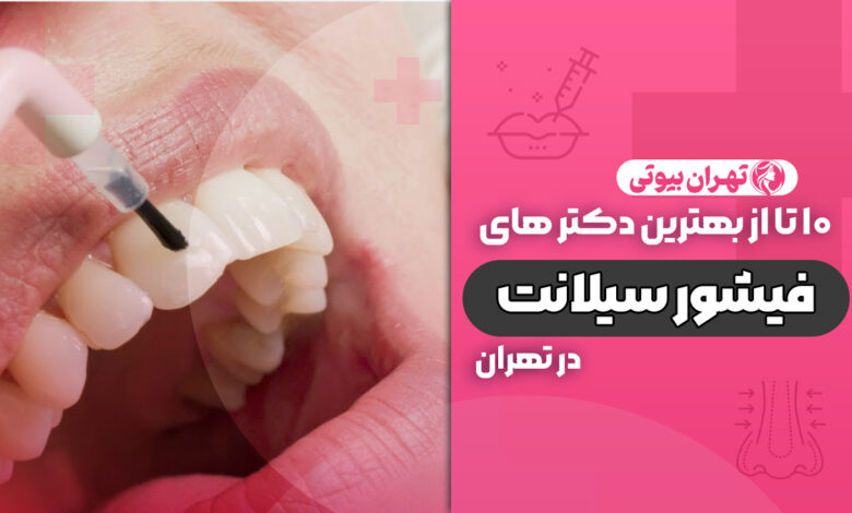 10 بهترین متخصص فیشور سیلانت در تهران