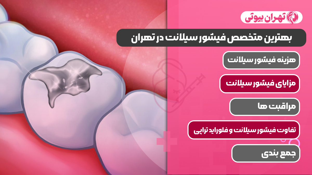 10 بهترین متخصص فیشور سیلانت در تهران