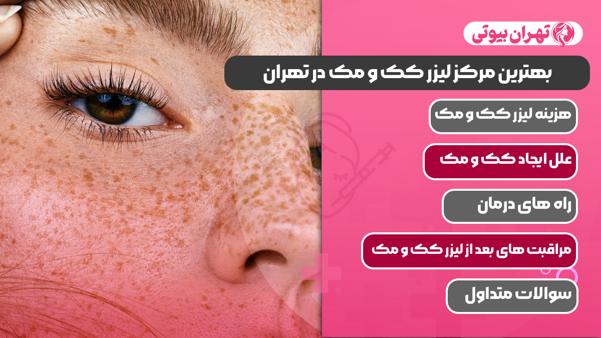 10 بهترین مرکز لیزر کک و مک در تهران