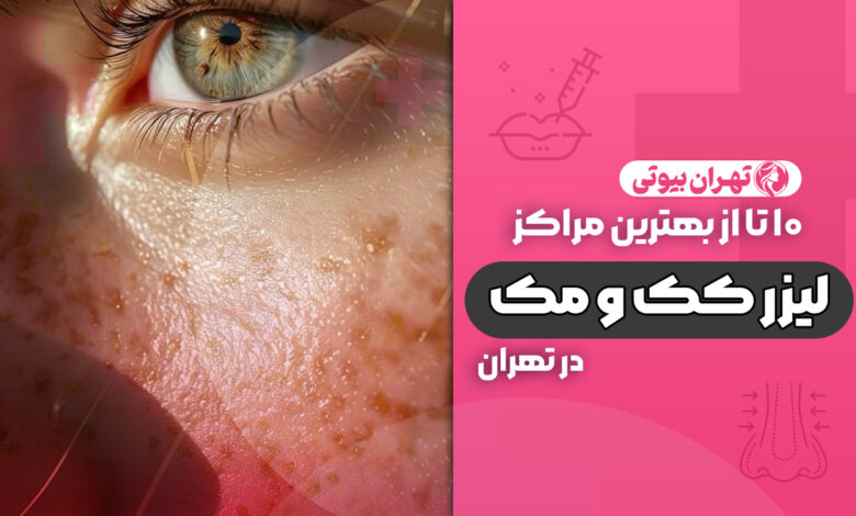 10 بهترین مرکز لیزر کک و مک در تهران