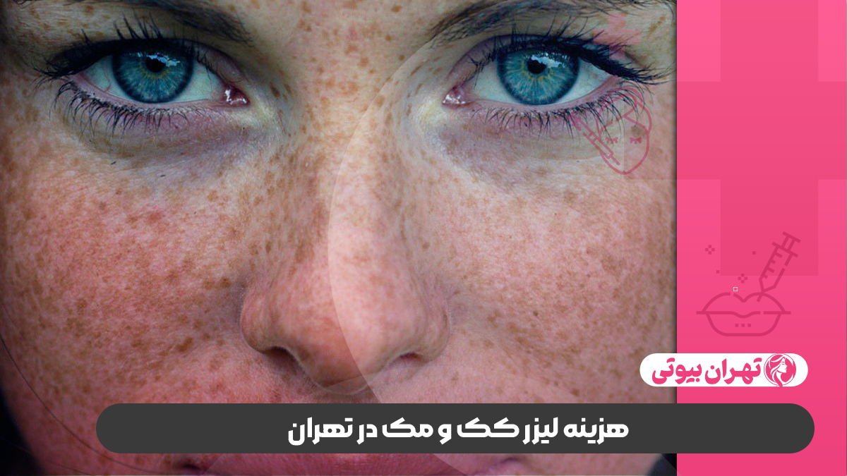 10 بهترین مرکز لیزر کک و مک در تهران