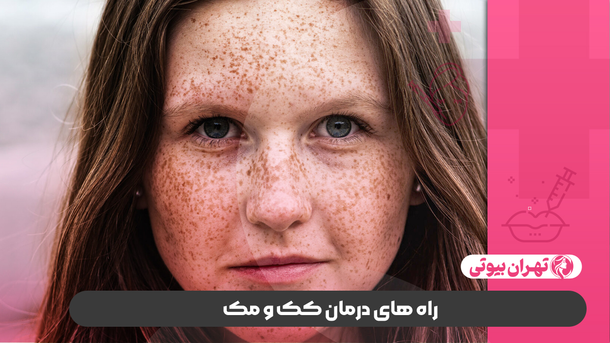 10 بهترین مرکز لیزر کک و مک در تهران