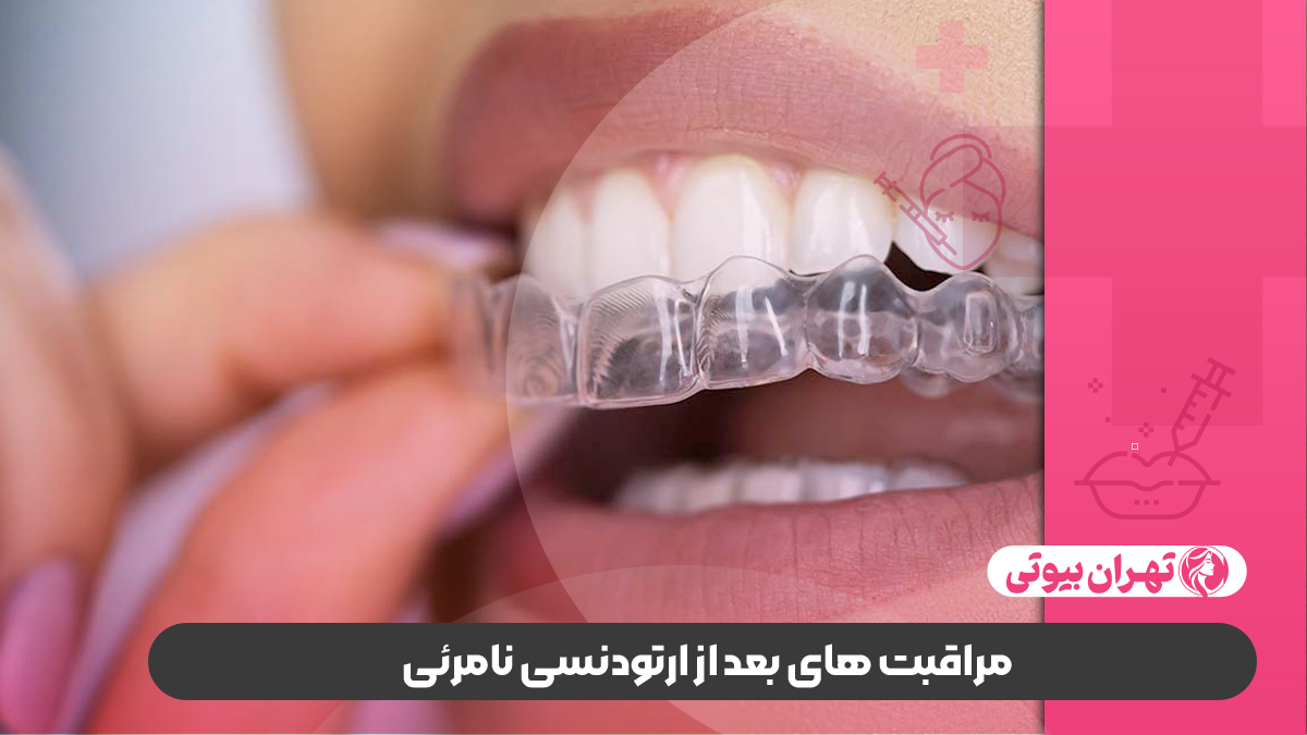 10 بهترین دکتر ارتودنسی نامرئی در تهران