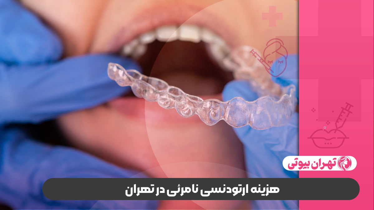 10 بهترین دکتر ارتودنسی نامرئی در تهران
