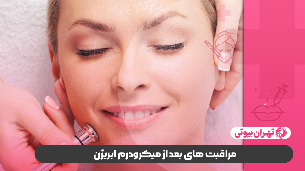 10 بهترین دکتر میکرودرم ابریژن در تهران