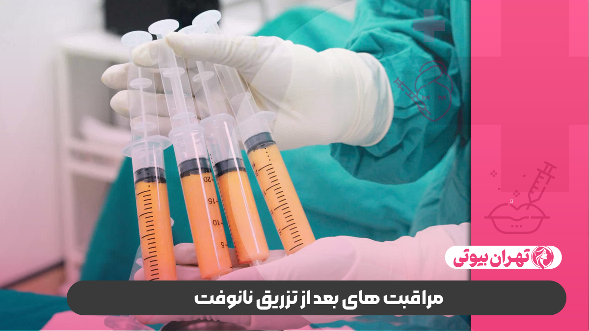 10 بهترین دکتر تزریق نانوفت در تهران