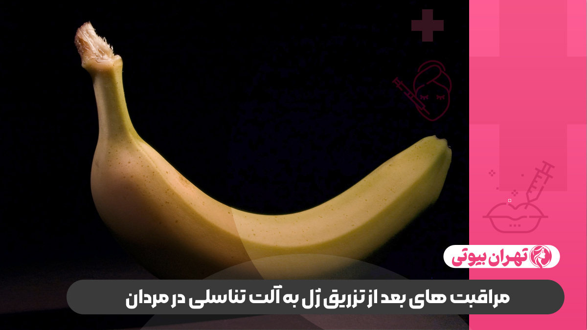 10 بهترین دکتر تزریق ژل به آلت تناسلی مردان در تهران