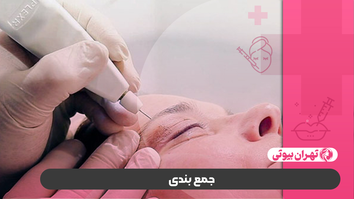 10 بهترین مرکز لیزر پلکسر در تهران