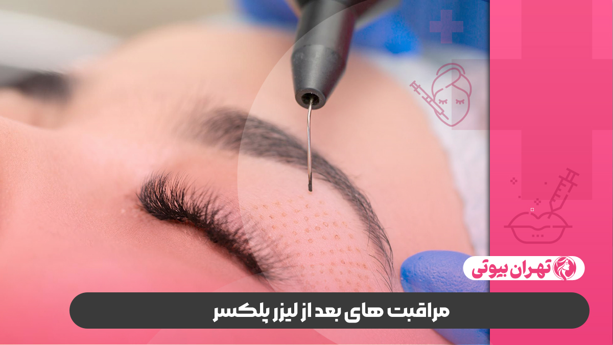 10 بهترین مرکز لیزر پلکسر در تهران