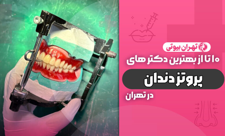 10 بهترین دکتر پروتز دندان در تهران