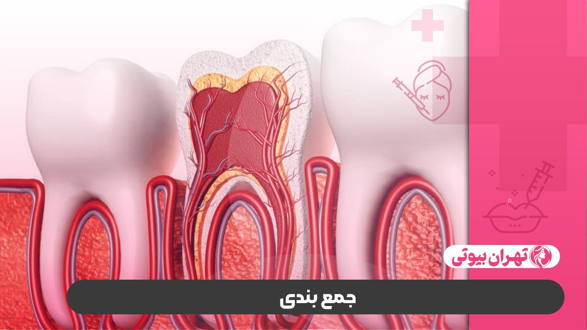 10 بهترین دکتر عصب کشی در تهران