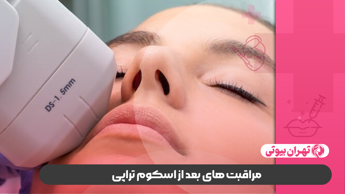 10 بهترین مرکز اسکوم تراپی در تهران