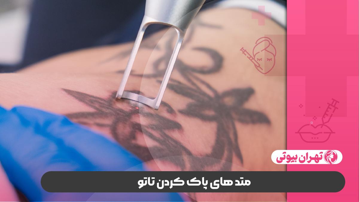 10 بهترین مرکز پاک کردن تاتو در تهران