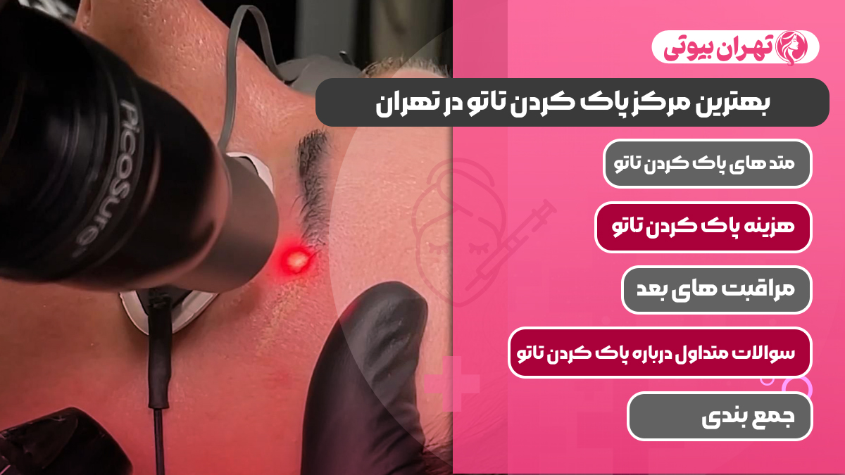10 بهترین مرکز پاک کردن تاتو در تهران