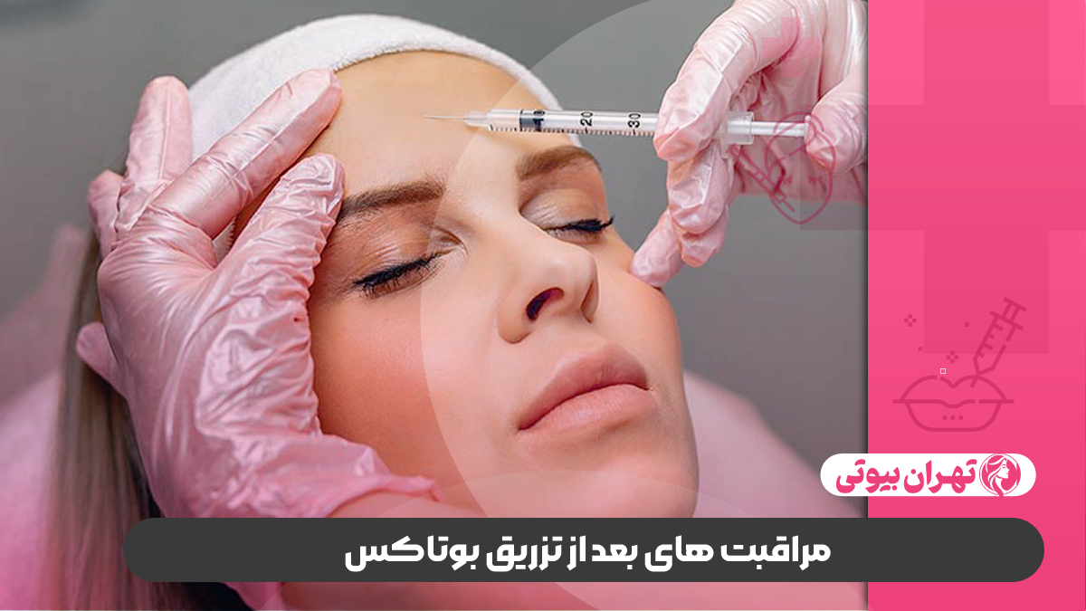 10 بهترین دکتر تزریق بوتاکس در کرج