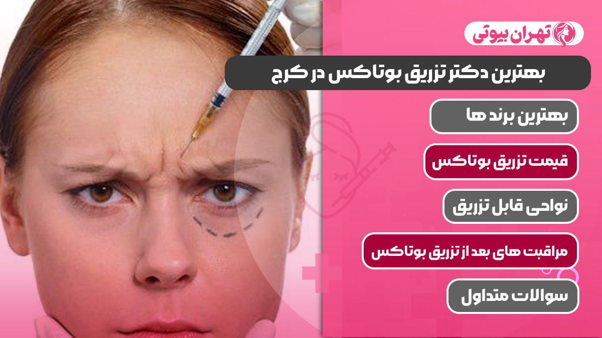 10 بهترین دکتر تزریق بوتاکس در کرج