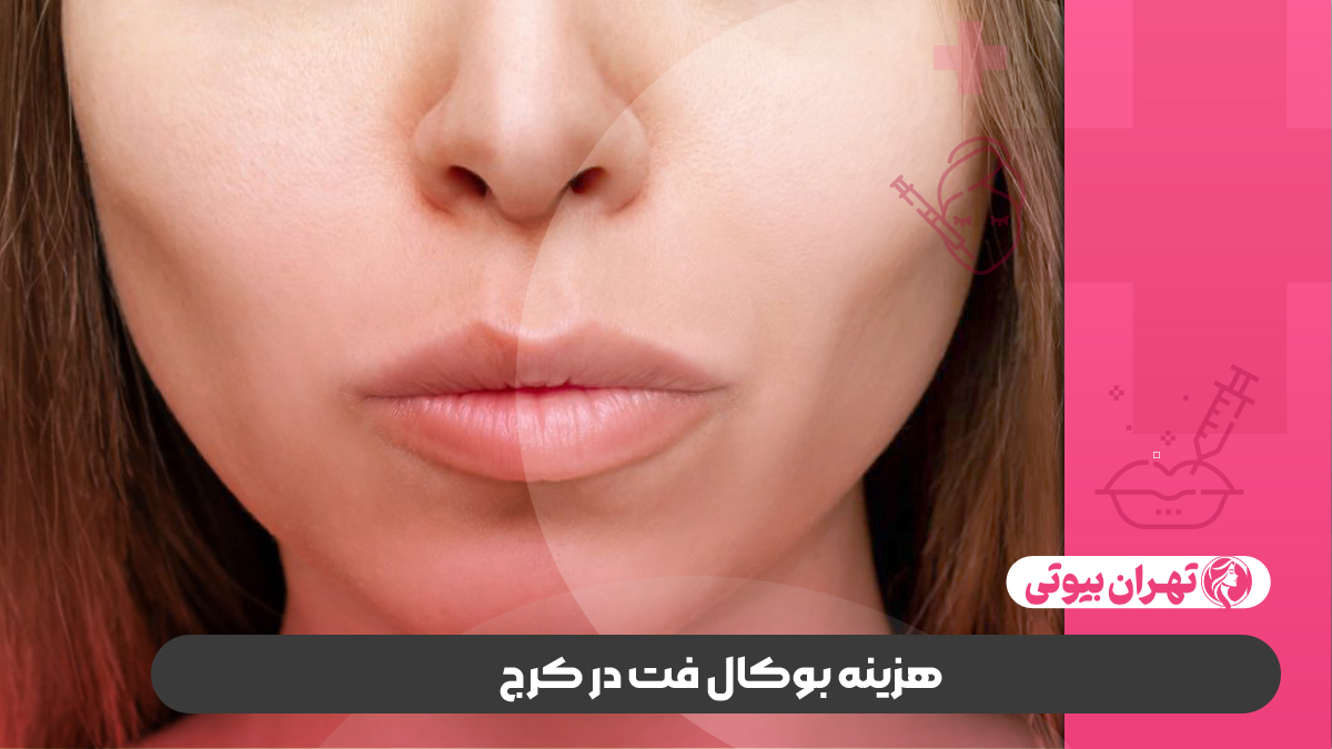 10 بهترین دکتر عمل بوکال فت در کرج