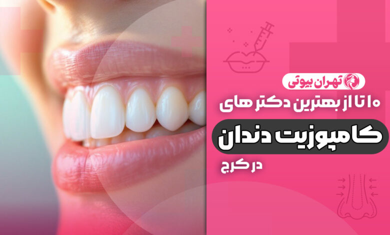 10 بهترین دکتر کامپوزیت دندان در کرج