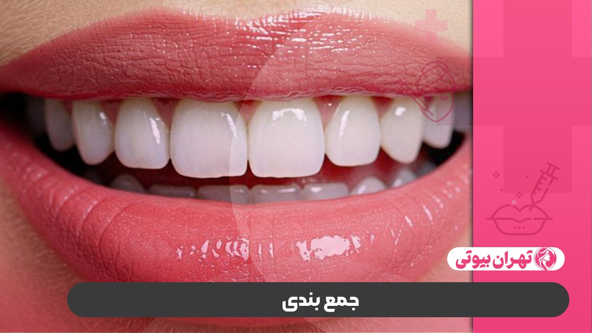 10 بهترین دکتر کامپوزیت دندان در کرج