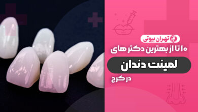 10 بهترین دکتر لمینت دندان در کرج