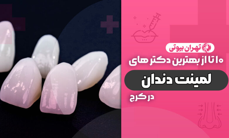 10 بهترین دکتر لمینت دندان در کرج