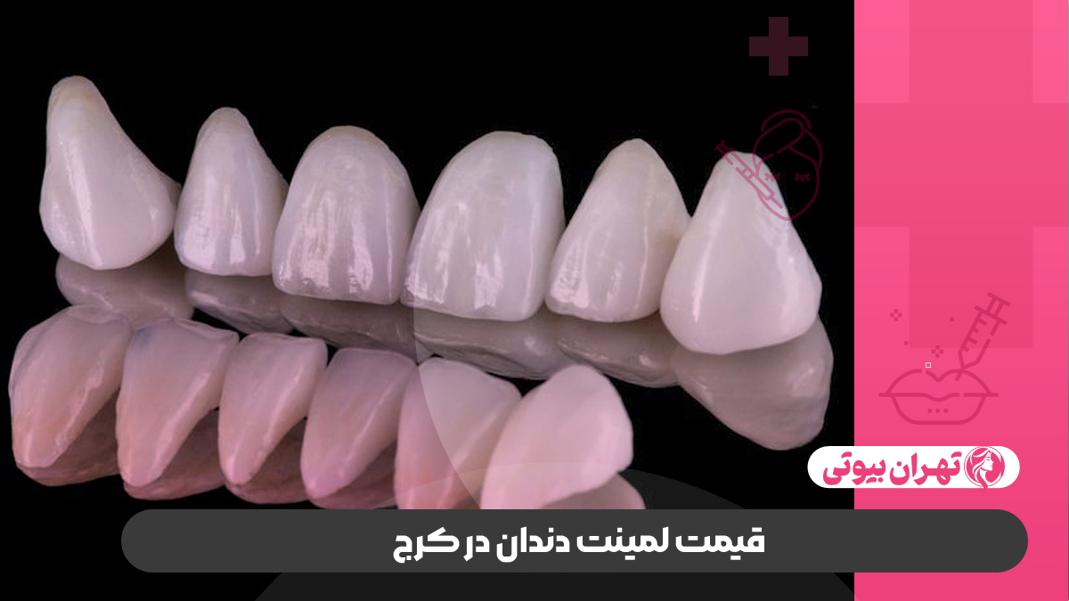 10 بهترین دکتر لمینت دندان در کرج
