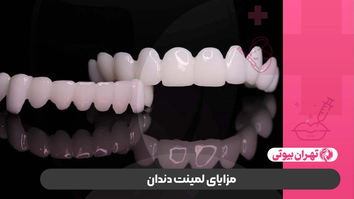 10 بهترین دکتر لمینت دندان در کرج