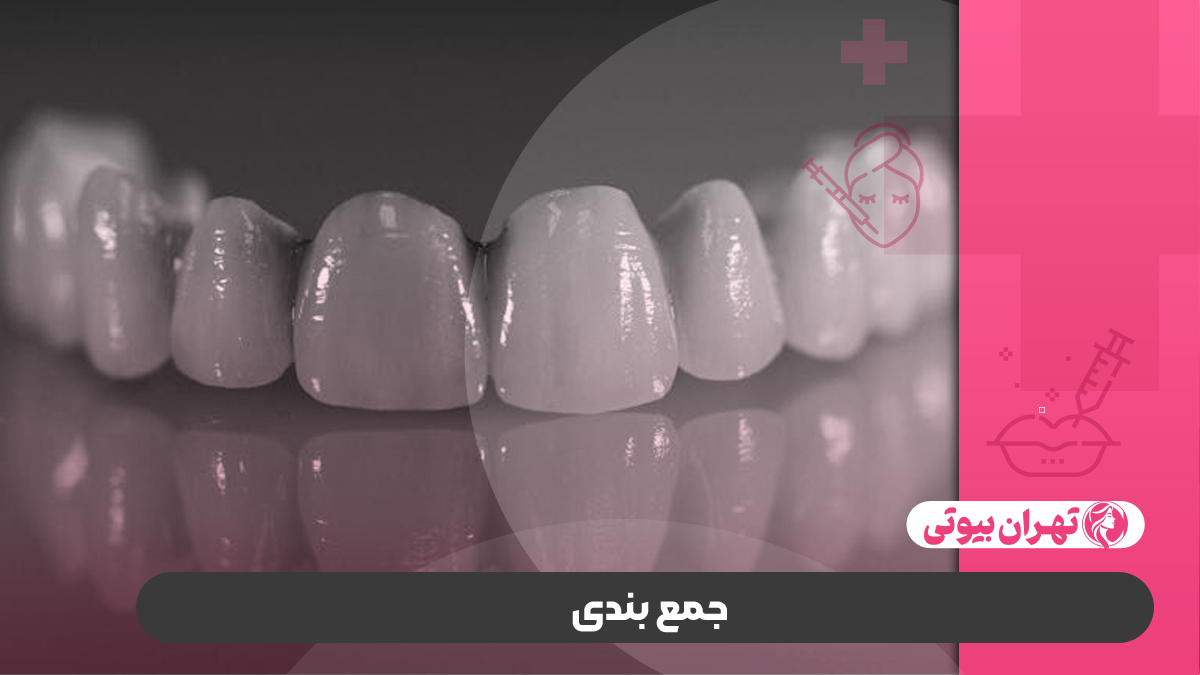 10 بهترین دکتر لمینت دندان در کرج