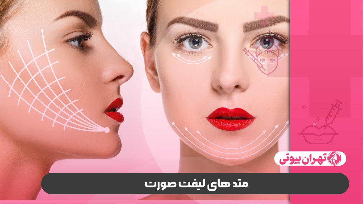 10 بهترین دکتر لیفت صورت در کرج