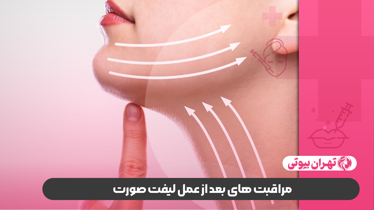 10 بهترین دکتر لیفت صورت در کرج