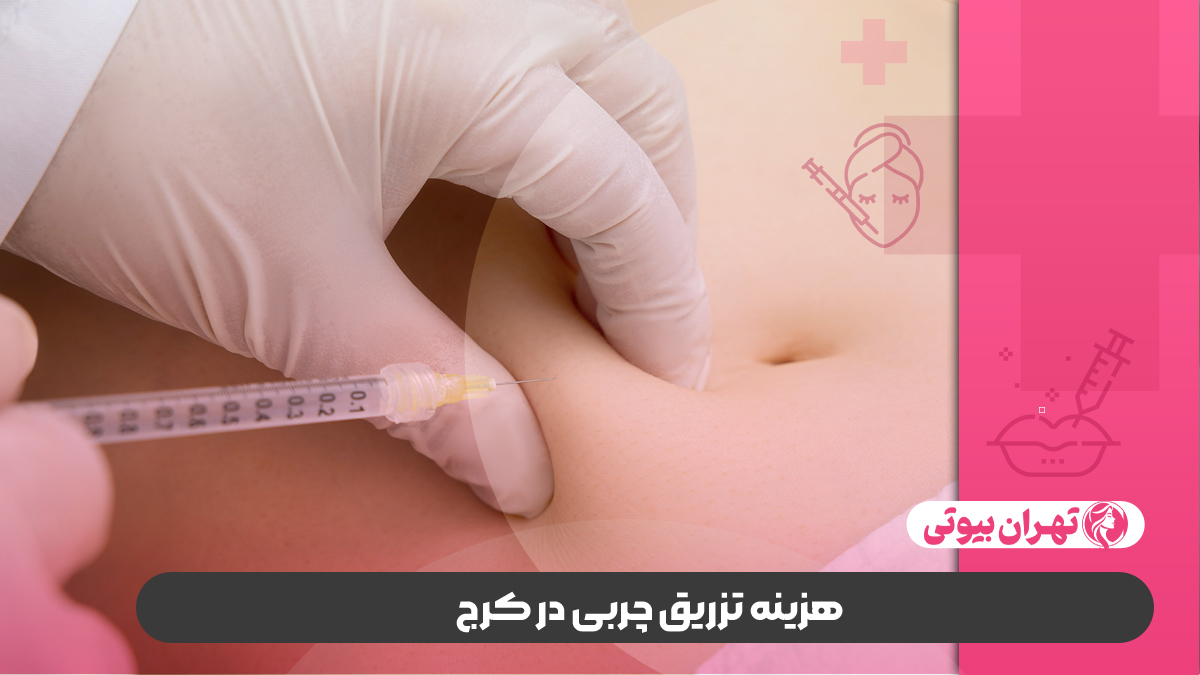 10 بهترین دکتر تزریق چربی در کرج