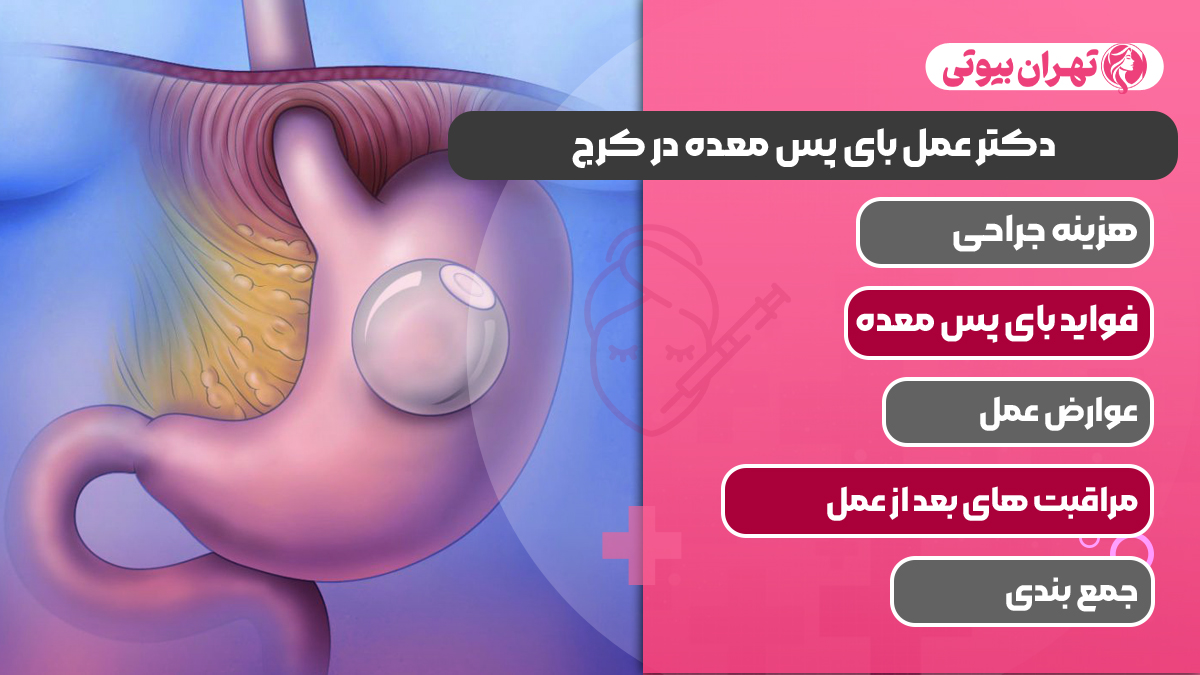 10 بهترین دکتر عمل بای پس معده در کرج