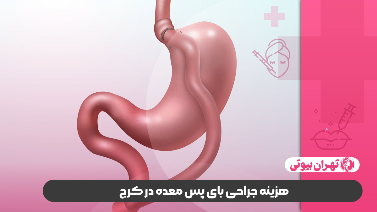 10 بهترین دکتر عمل بای پس معده در کرج